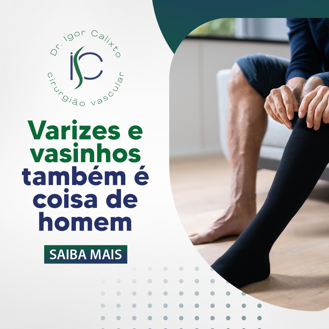 Varizes e vasinhos